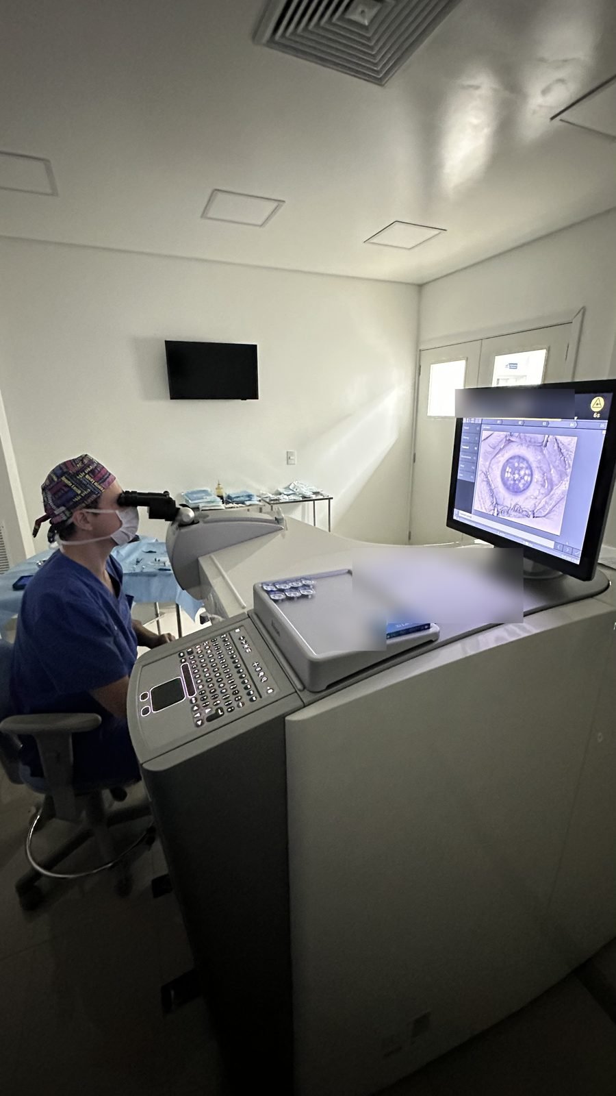Dr. Jefferson Batista operando com o laser WaveLight EX500 na Pró-Oftalmo
