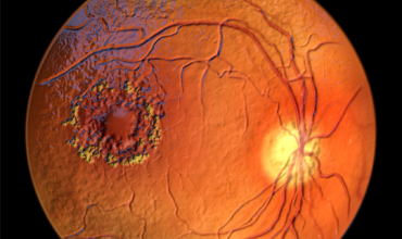 Avanço na detecção precoce da Retinopatia Diabética: Pesquisadores brasileiros identificam sinais antes das lesões na retina