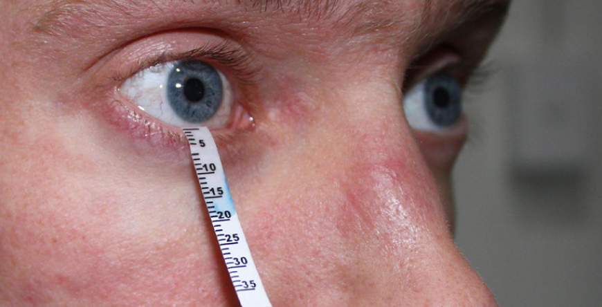 ESTUDO DA PELÍCULA LACRIMAL